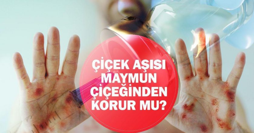 Çiçek hastalığı aşısı maymun hastalığına (Mpox) karşı koruma sağlar mı?