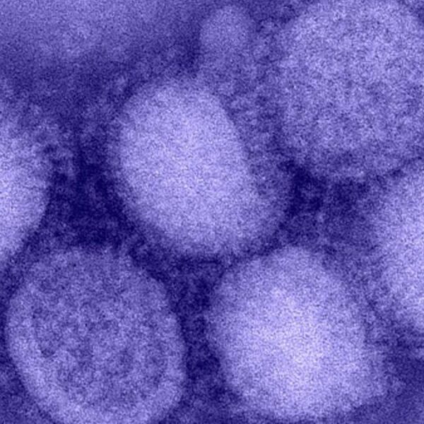 Kuzey Yarımküre’de ‘H3N2’ alarmı! “Benzeri görülmemiş grip vakaları yaşanıyor”