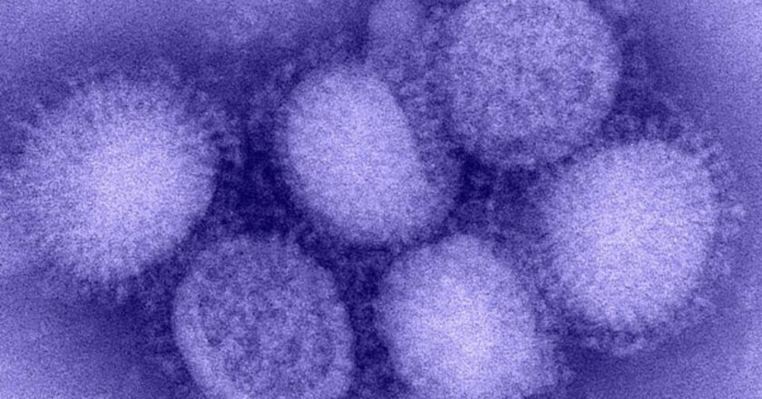 Kuzey Yarımküre’de ‘H3N2’ alarmı! “Benzeri görülmemiş grip vakaları yaşanıyor”